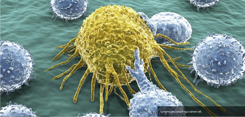 Lymfocyty útočiace na rakovinovú bunku. 